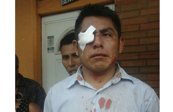 Opinión de Samuel Aguirre: Brutal agresión de panistas en contra de la población de Soteapan 