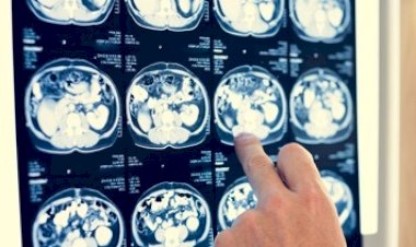 REPORTAJE | Atención neurológica, un lujo en México